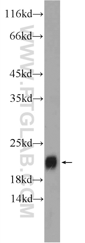 Western Blot (WB) analysis of rat spleen tissue using TIPE2 Polyclonal antibody (15940-1-AP)