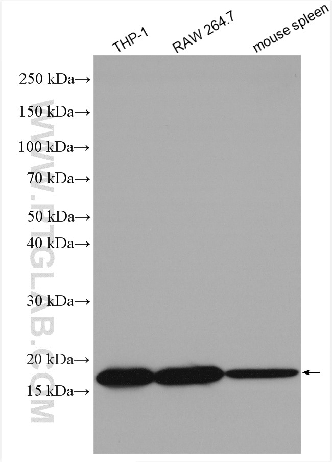 Western Blot (WB) analysis of various lysates using TIPE2 Polyclonal antibody (15940-1-AP)