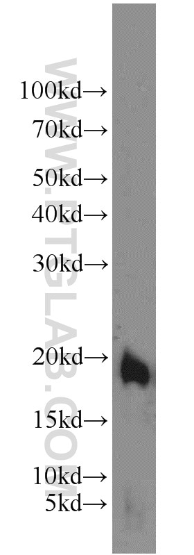 Western Blot (WB) analysis of mouse small intestine tissue using TIPE2 Polyclonal antibody (15940-1-AP)