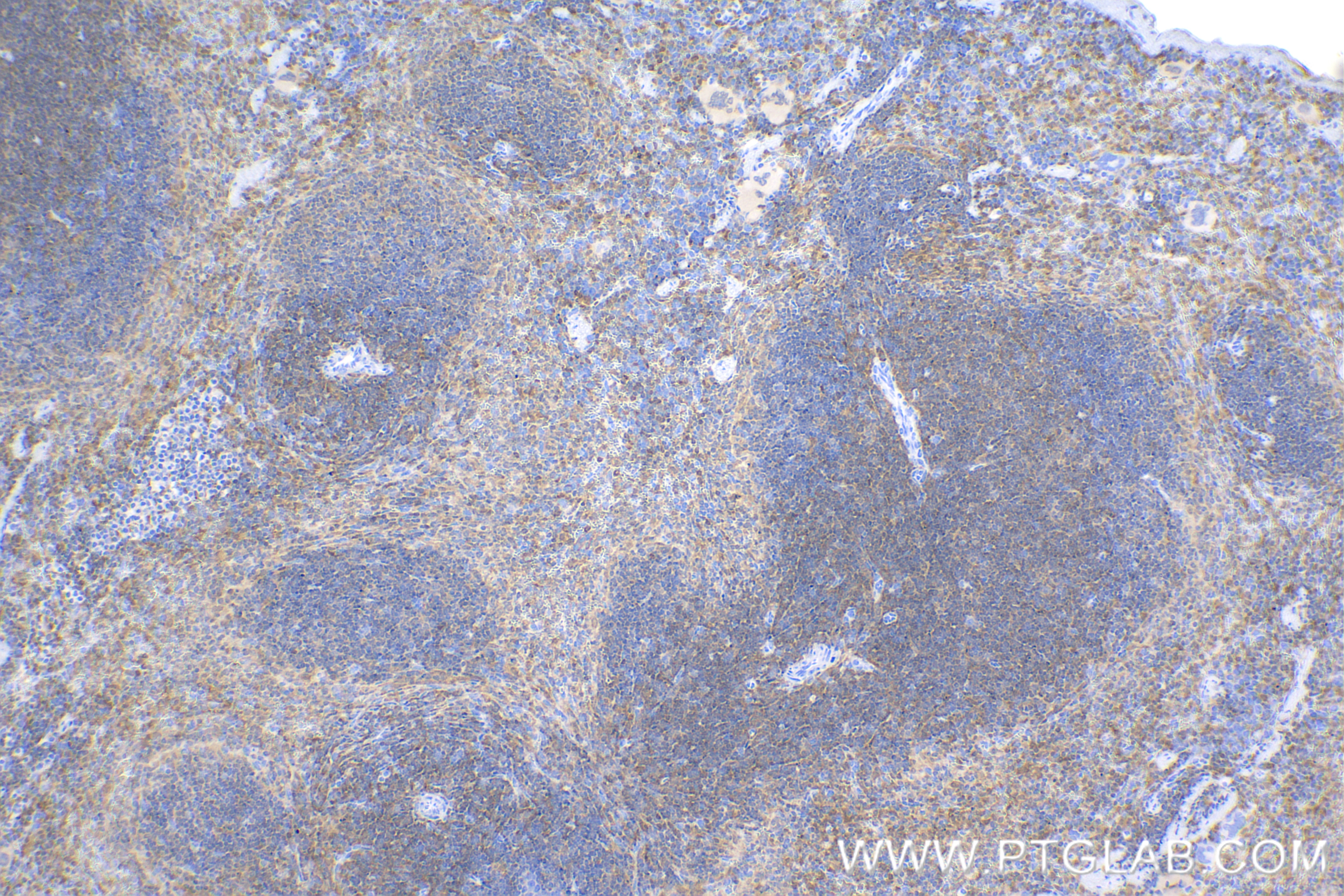 Immunohistochemistry (IHC) staining of mouse spleen tissue using TNFAIP8L2 Recombinant antibody (85759-4-RR)