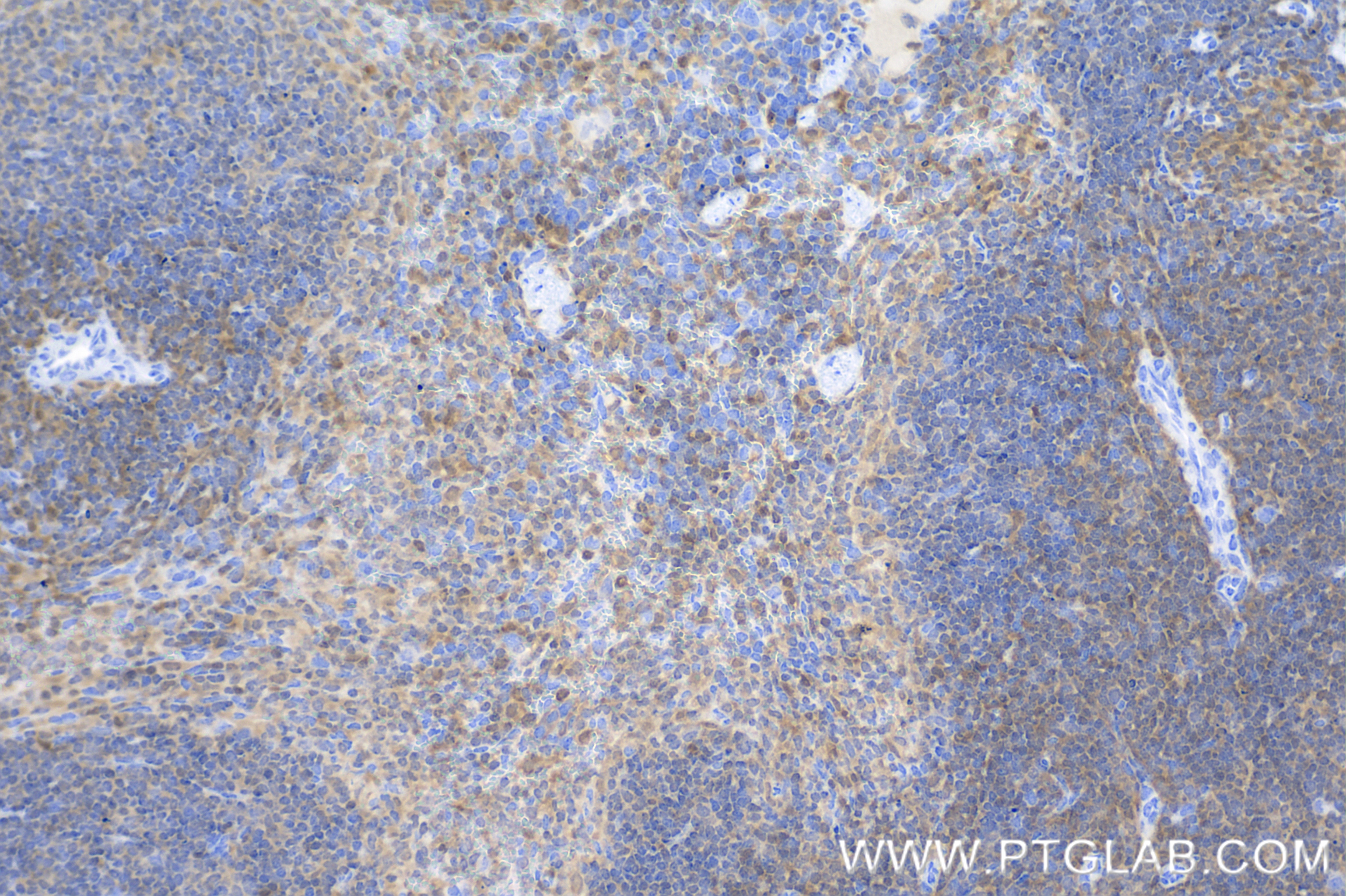 Immunohistochemistry (IHC) staining of mouse spleen tissue using TNFAIP8L2 Recombinant antibody (85759-4-RR)