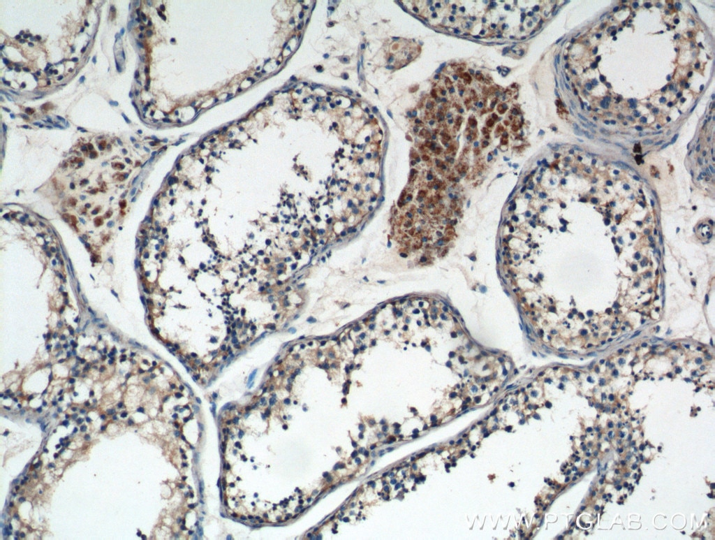 Immunohistochemistry (IHC) staining of human testis tissue using TNF Beta Polyclonal antibody (13111-1-AP)