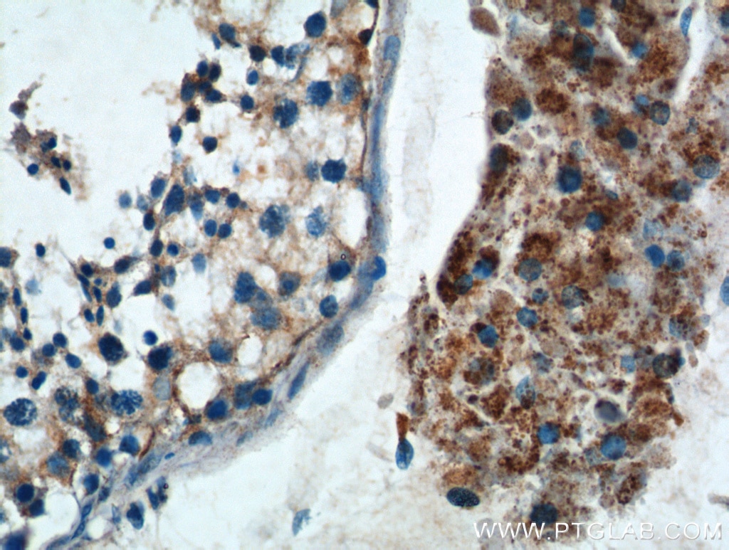 Immunohistochemistry (IHC) staining of human testis tissue using TNF Beta Polyclonal antibody (13111-1-AP)