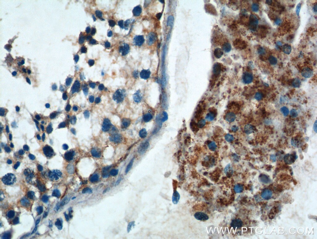 IHC staining of human testis using 13111-1-AP