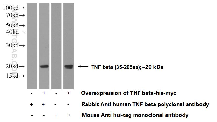 TNF Beta