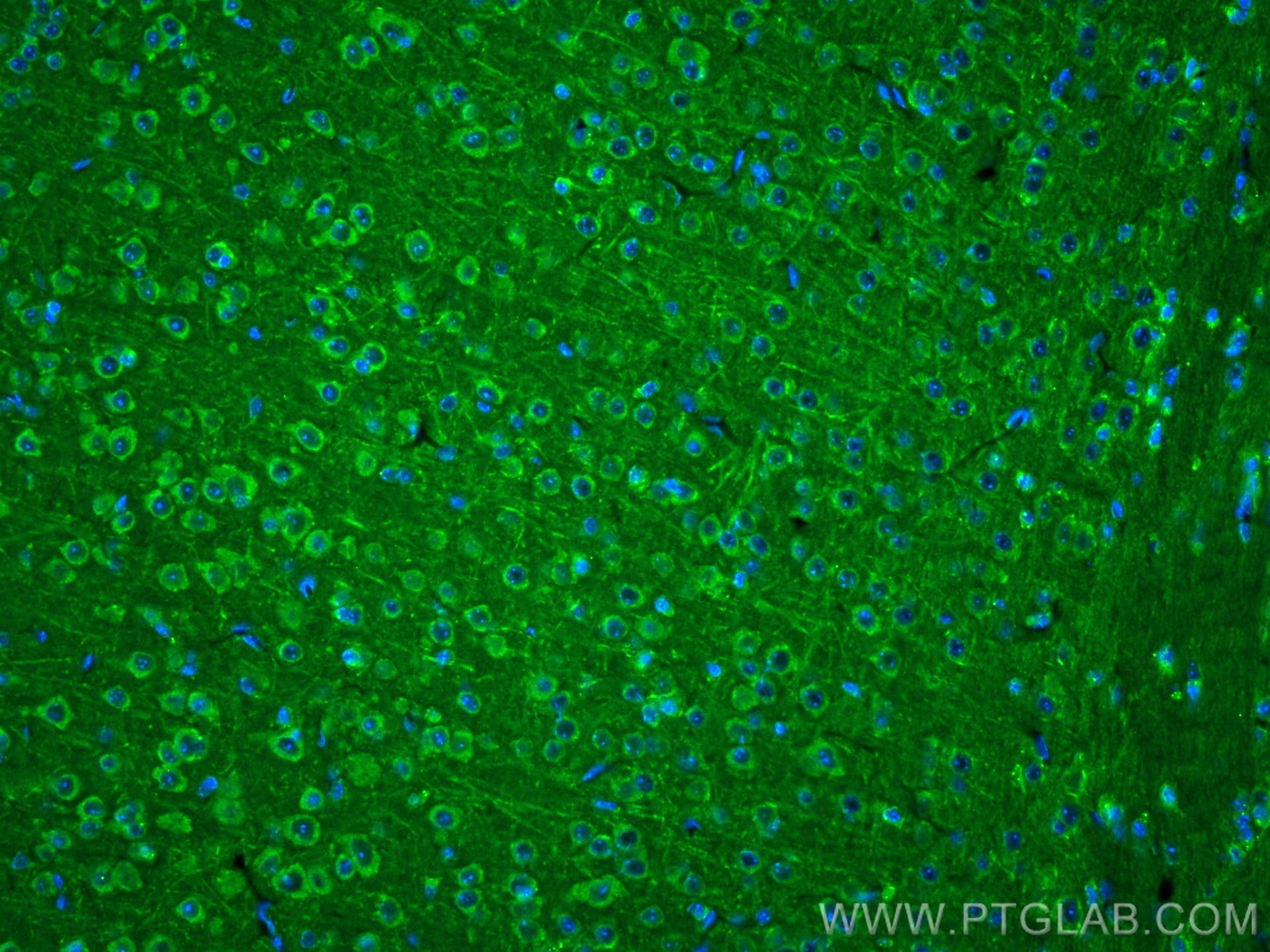 Immunofluorescence (IF) / fluorescent staining of mouse brain tissue using TNFR1 Polyclonal antibody (21574-1-AP)
