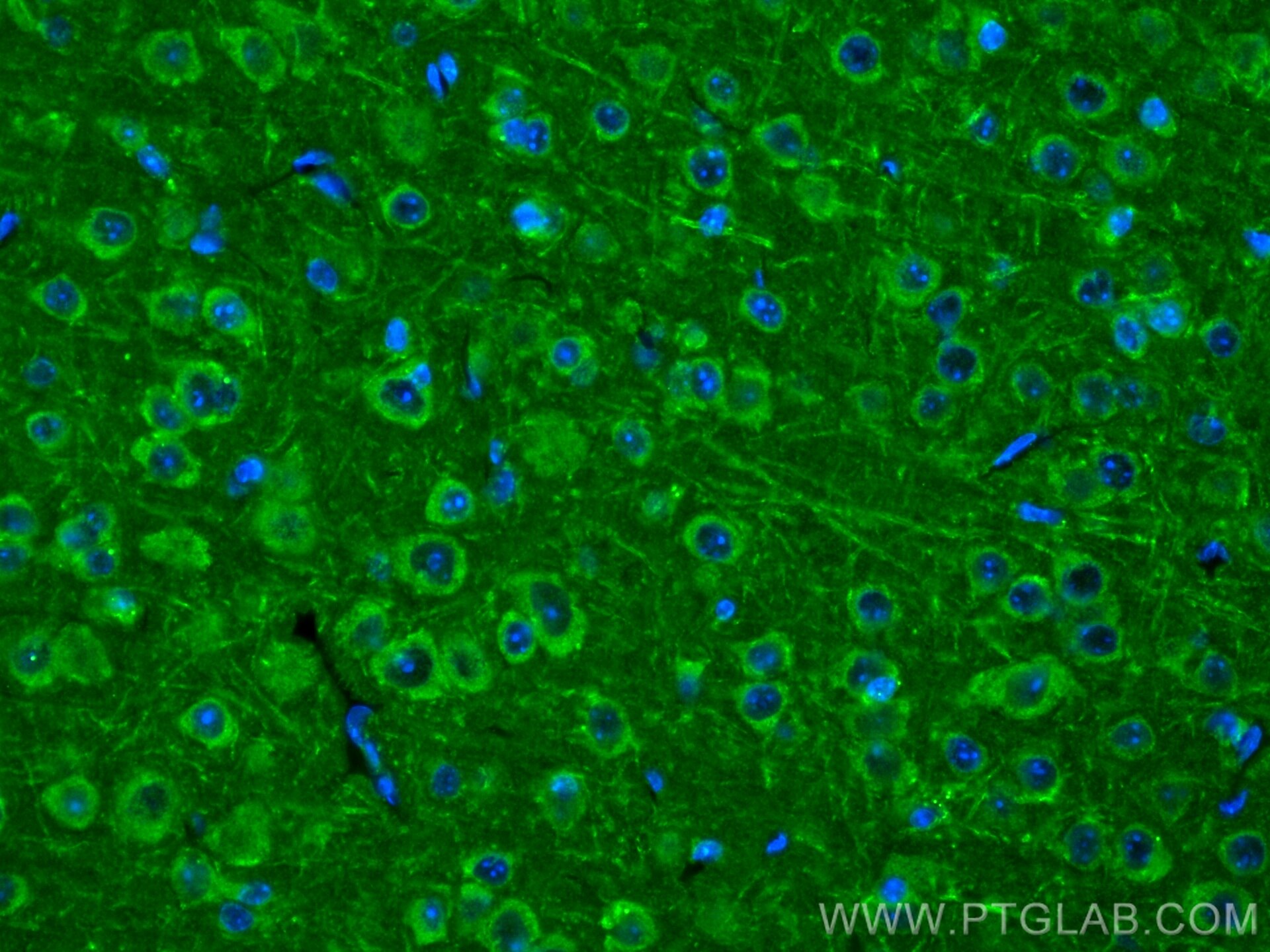 IF Staining of mouse brain using 21574-1-AP