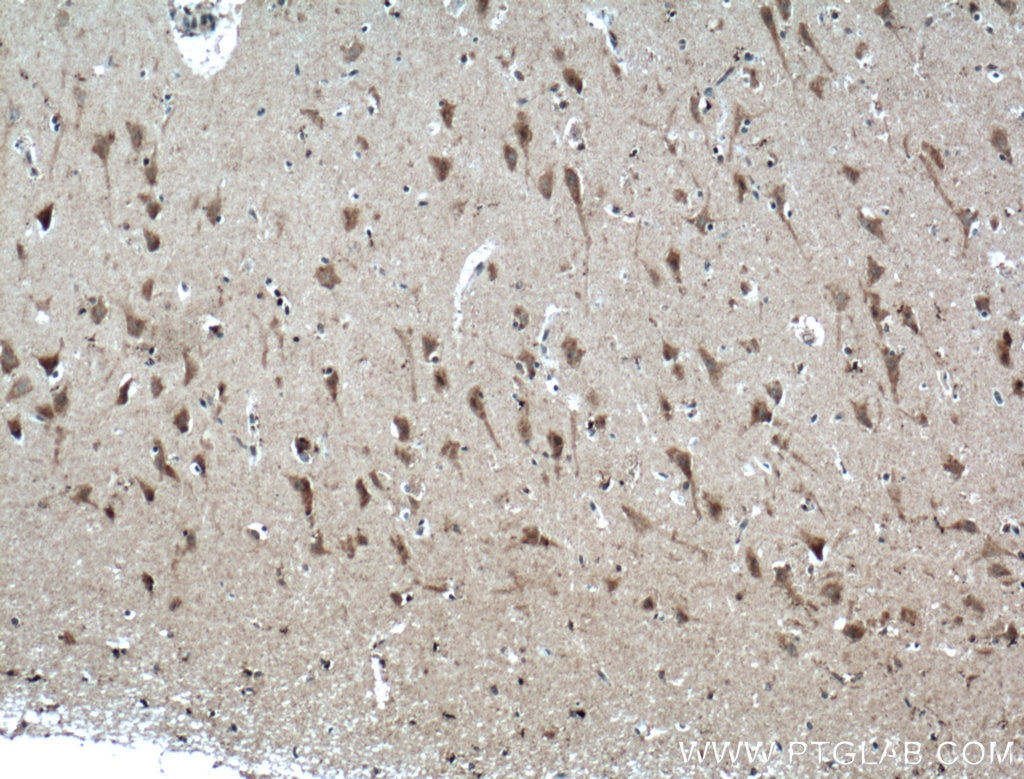 IHC staining of human brain using 21574-1-AP