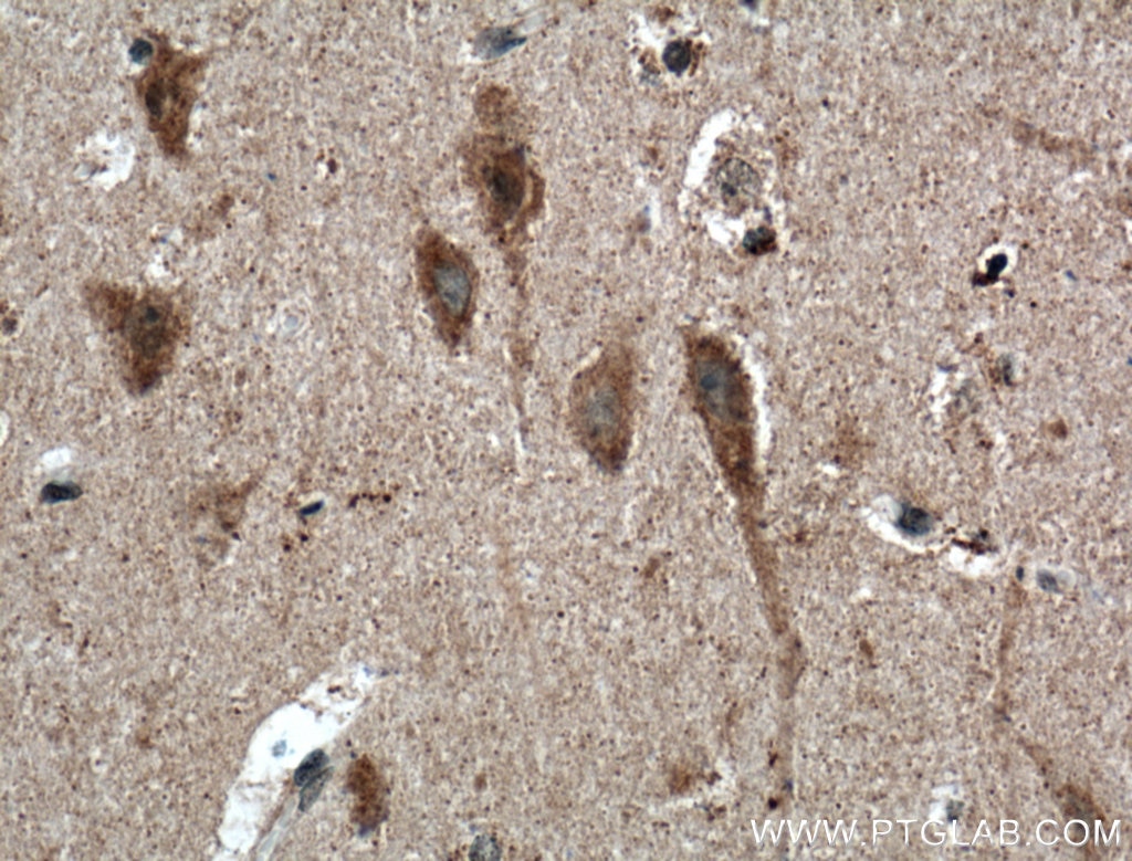 Immunohistochemistry (IHC) staining of human brain tissue using TNFR1 Polyclonal antibody (21574-1-AP)