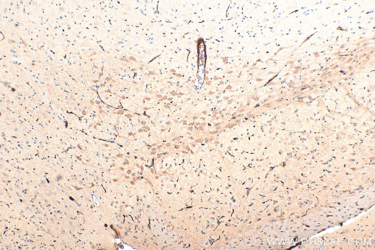 Immunohistochemistry (IHC) staining of mouse brain tissue using TNFR1/CD120a Polyclonal antibody (21574-1-AP)