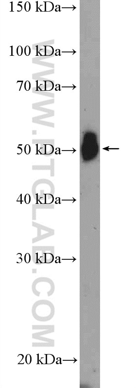 Western Blot (WB) analysis of HL-60 cells using TNFR1 Polyclonal antibody (21574-1-AP)