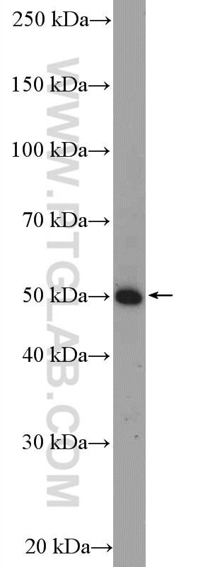 Western Blot (WB) analysis of Raji cells using TNFR1 Polyclonal antibody (21574-1-AP)