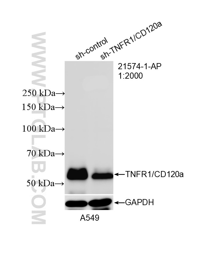 WB analysis of A549 using 21574-1-AP Western Blot (WB) analysis of A549 cells using TNFR1/CD120a Polyclonal antibody (21574-1-AP)