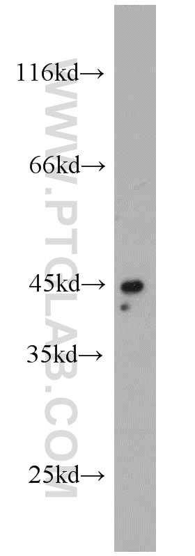 Western Blot (WB) analysis of human brain tissue using TNFR1 Polyclonal antibody (21574-1-AP)