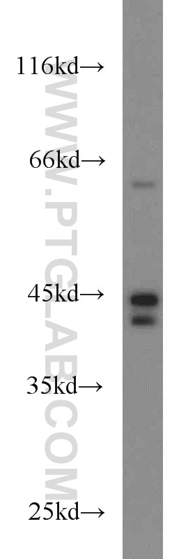 Western Blot (WB) analysis of HeLa cells using TNFR1 Polyclonal antibody (21574-1-AP)
