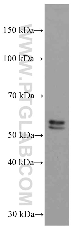Western Blot (WB) analysis of Daudi cells using TNFR1 Monoclonal antibody (60192-1-Ig)