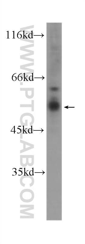 Western Blot (WB) analysis of HL-60 cells using TNFR1 Monoclonal antibody (60192-1-Ig)