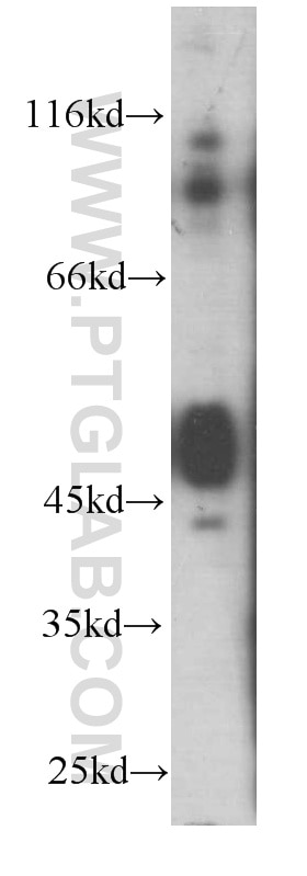 TNFR1 Monoclonal antibody