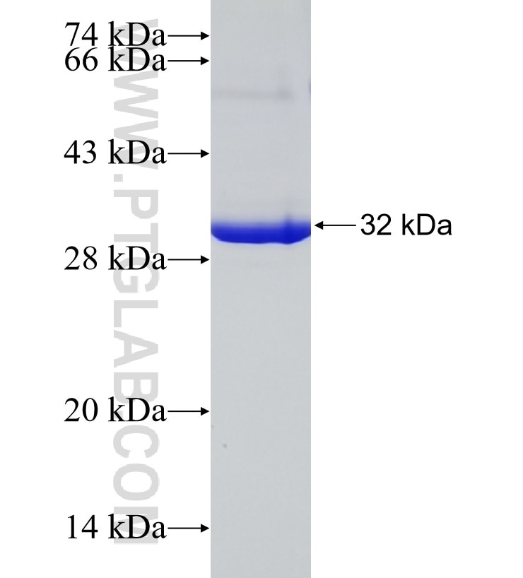 TNFR1 fusion protein Ag17070 SDS-PAGE