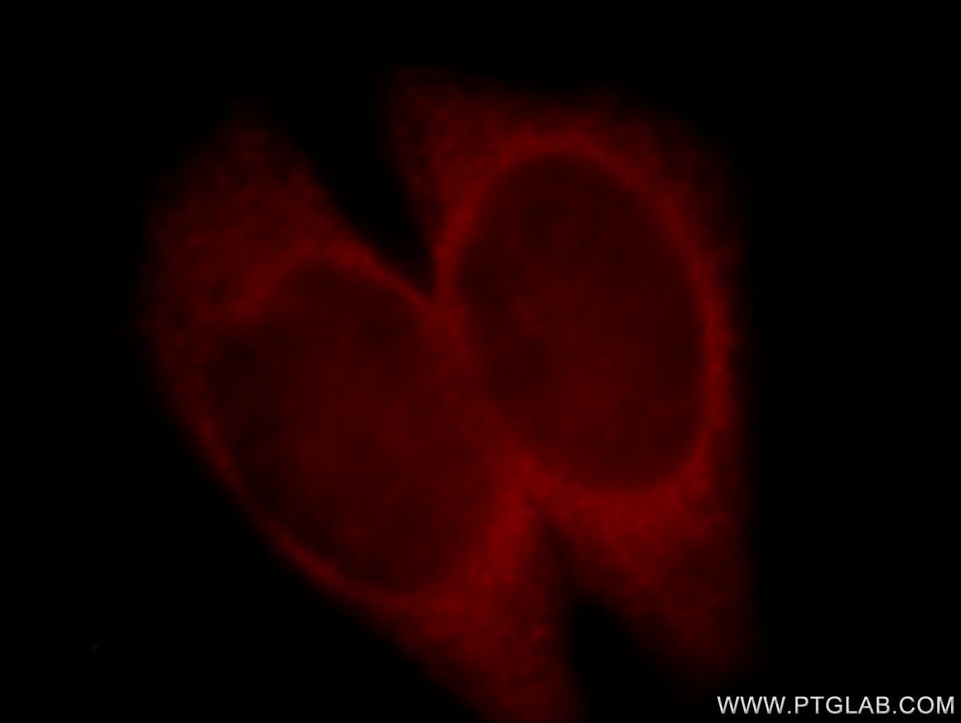 Immunofluorescence (IF) / fluorescent staining of HeLa cells using TNFR2 / TNFRSF1B Polyclonal antibody (19272-1-AP)