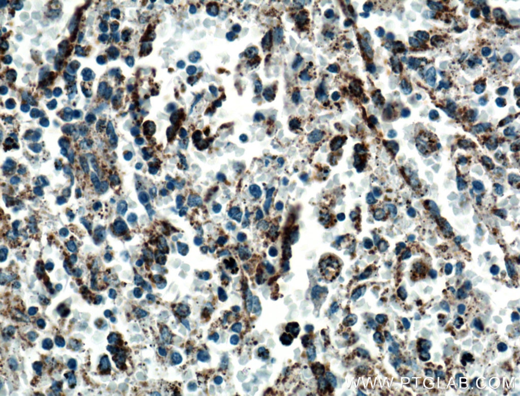 Immunohistochemistry (IHC) staining of human spleen tissue using TNFR2 Polyclonal antibody (19272-1-AP)