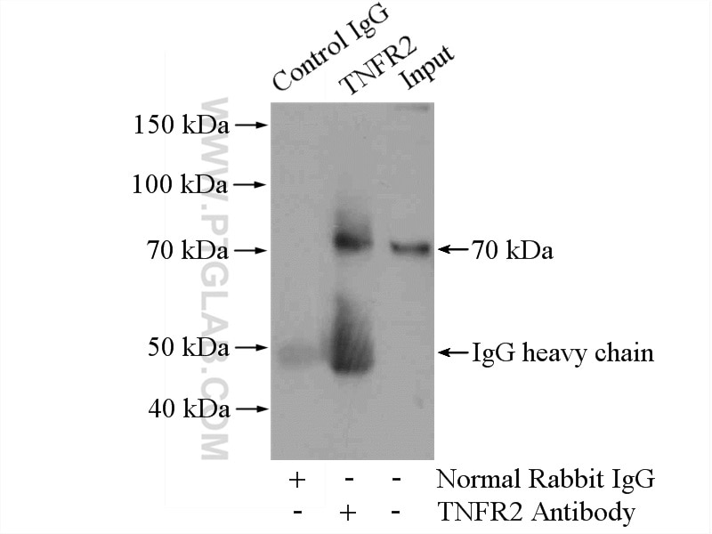 Immunoprecipitation (IP) experiment of HEK-293 cells using TNFR2 / TNFRSF1B Polyclonal antibody (19272-1-AP)