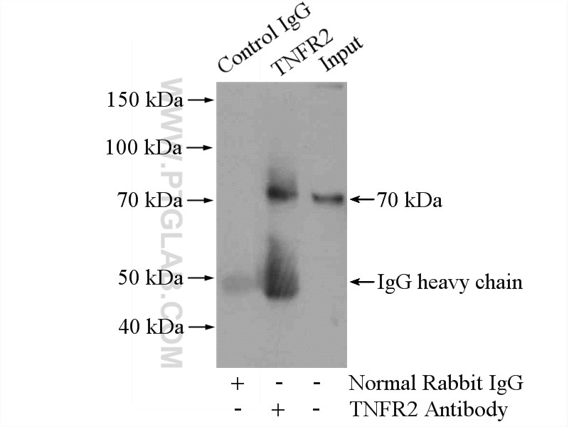 IP experiment of HEK-293 using 19272-1-AP