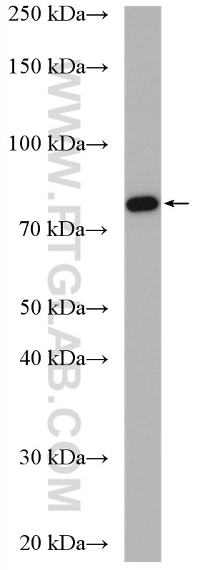 Western Blot (WB) analysis of Jurkat cells using TNFR2 Polyclonal antibody (19272-1-AP)