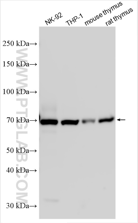 Western Blot (WB) analysis of various lysates using TNFR2 / TNFRSF1B Polyclonal antibody (19272-1-AP)