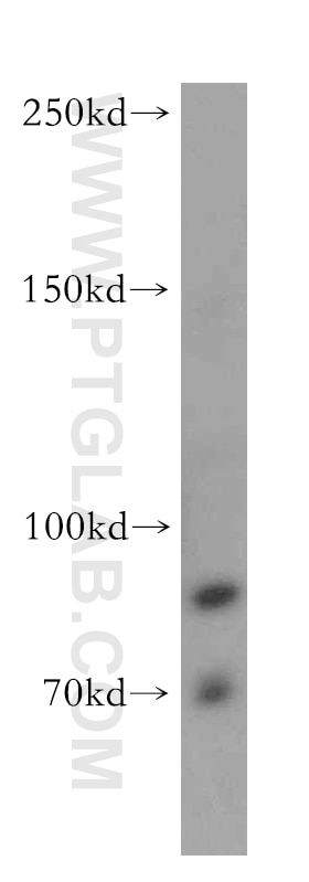 Western Blot (WB) analysis of MCF-7 cells using TNFR2 / TNFRSF1B Polyclonal antibody (19272-1-AP)