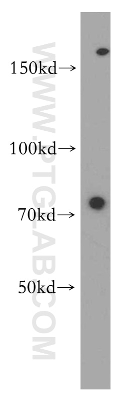 Western Blot (WB) analysis of HEK-293 cells using TNFR2 Polyclonal antibody (19272-1-AP)