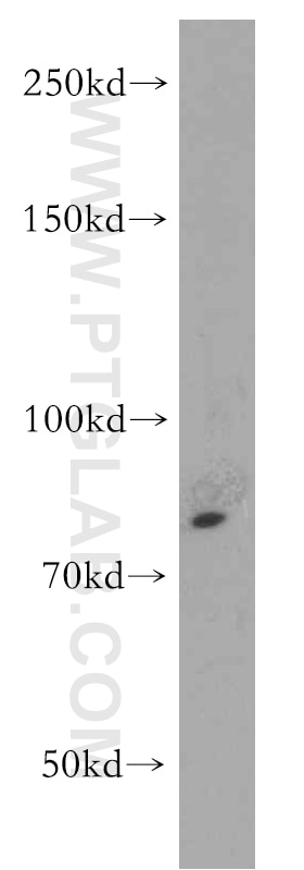 TNFR2 / TNFRSF1B Polyclonal antibody