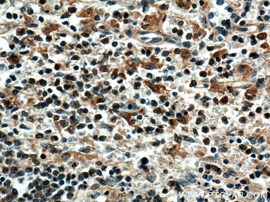 Immunohistochemistry (IHC) staining of human spleen tissue using TNFR2 Polyclonal antibody (28746-1-AP)