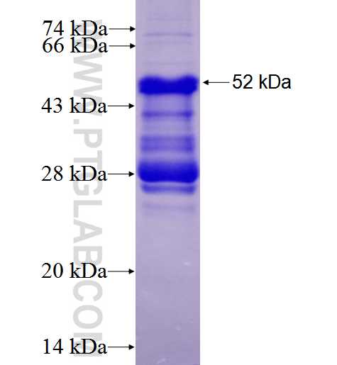 TNFR2 fusion protein Ag5858 SDS-PAGE