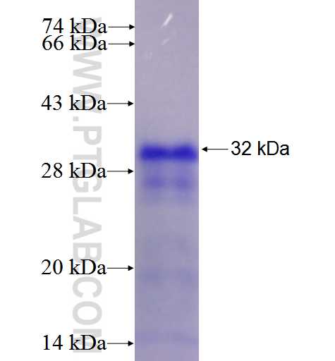 TNFR2 fusion protein Ag5866 SDS-PAGE