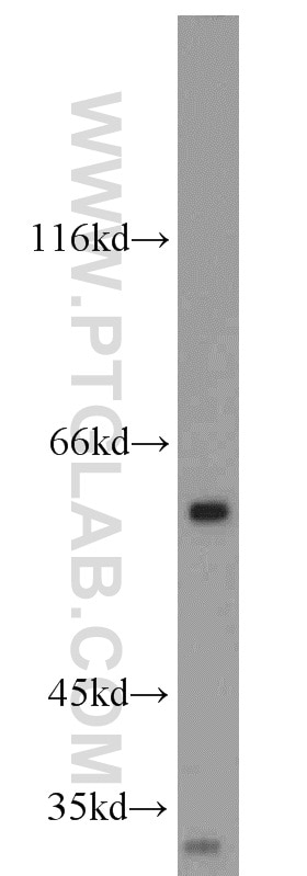 Western Blot (WB) analysis of HL-60 cells using DR5-Specific Polyclonal antibody (15497-1-AP)