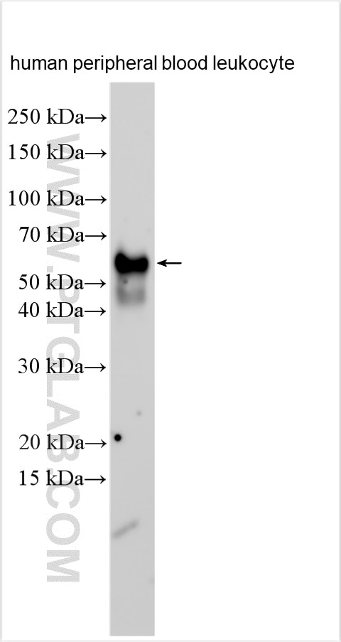 Western Blot (WB) analysis of human peripheral blood leukocyte using DcR1/TNFRSF10C Polyclonal antibody (24622-1-AP)