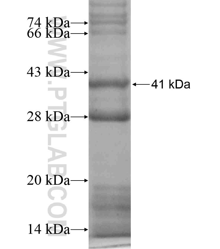 TNFRSF10C fusion protein Ag18399 SDS-PAGE