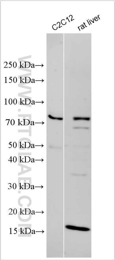 Western Blot (WB) analysis of various lysates using RANK/TNFRSF11A Polyclonal antibody (32528-1-AP)