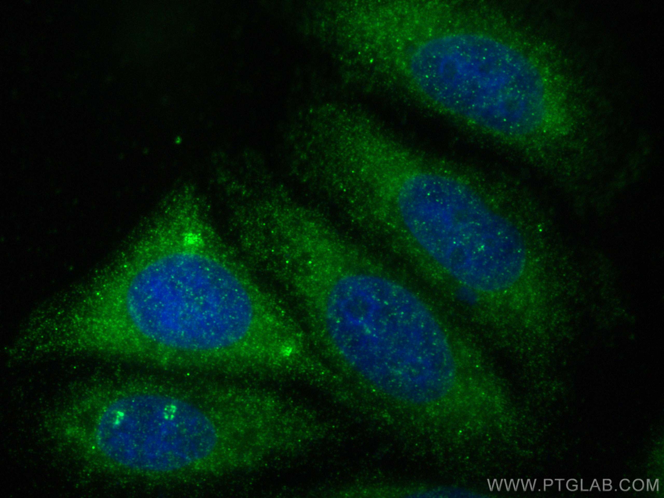Immunofluorescence (IF) / fluorescent staining of HepG2 cells using Osteoprotegerin/TNFRSF11B Polyclonal antibody (11534-1-AP)