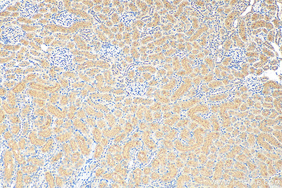 Immunohistochemistry (IHC) staining of rat kidney tissue using Osteoprotegerin/TNFRSF11B Polyclonal antibody (11534-1-AP)