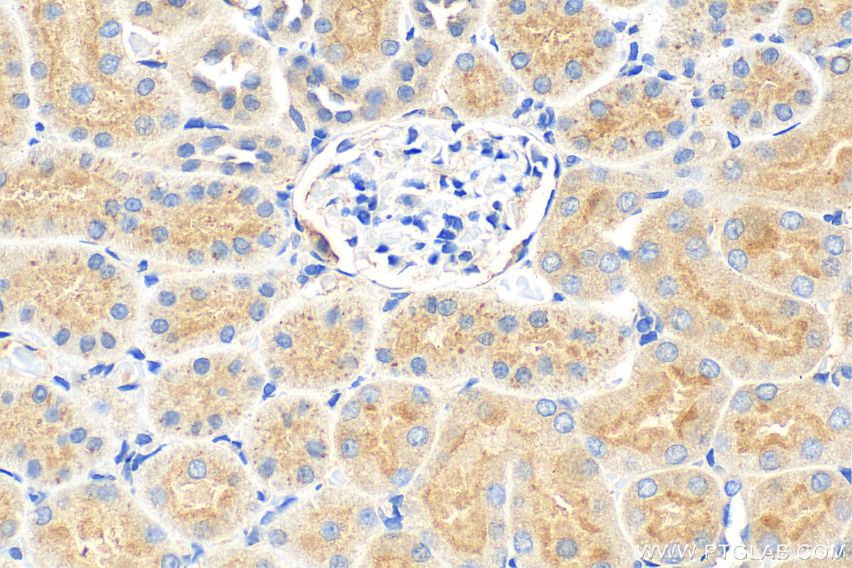 Immunohistochemistry (IHC) staining of rat kidney tissue using Osteoprotegerin/TNFRSF11B Polyclonal antibody (11534-1-AP)