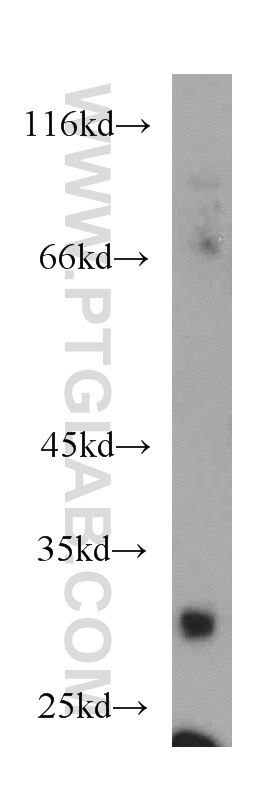 Western Blot (WB) analysis of K-562 cells using TNFRSF13B Polyclonal antibody (21520-1-AP)