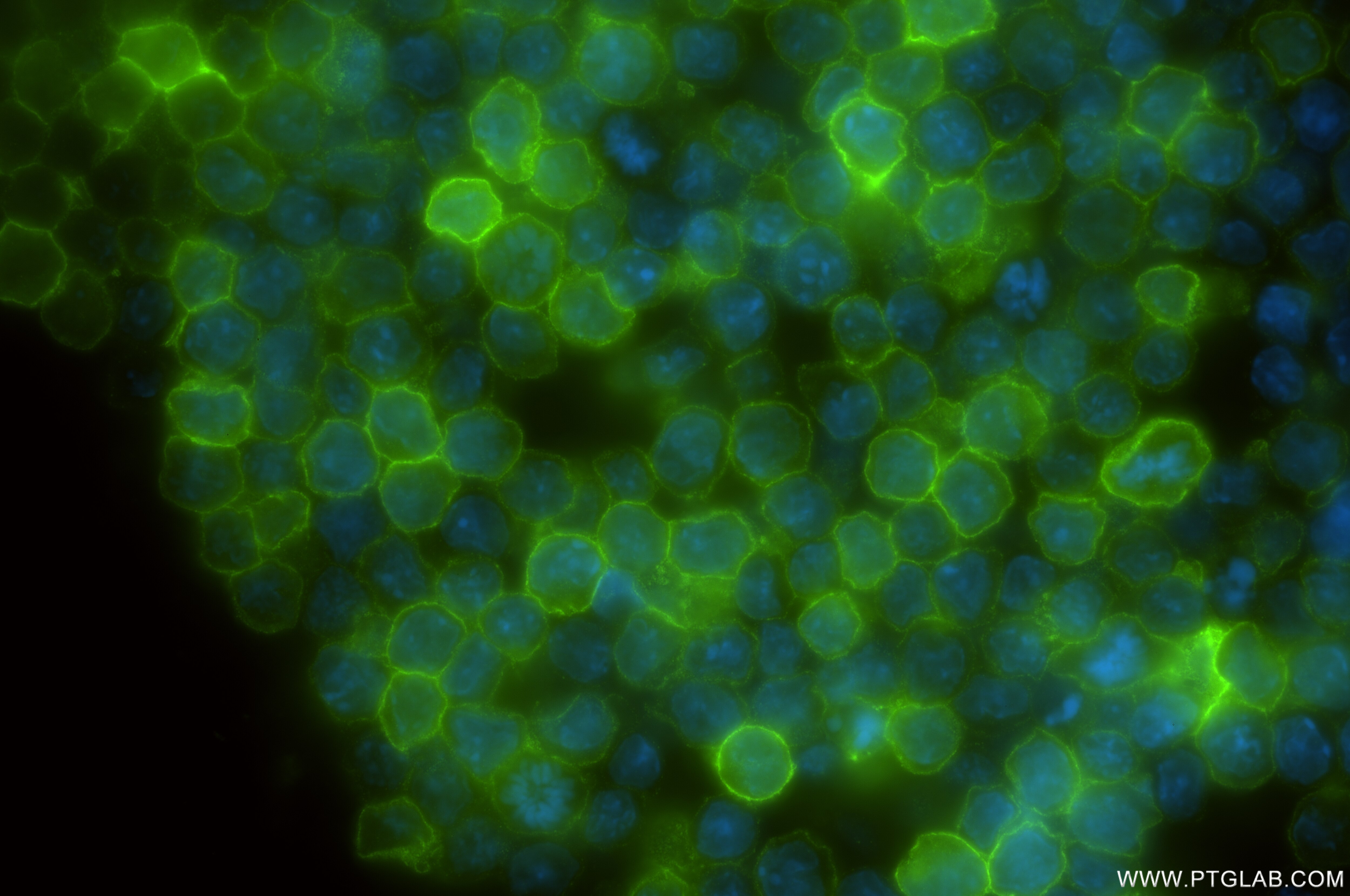 Immunofluorescence (IF) / fluorescent staining of A20 cells using TNFRSF13B/CD267 Recombinant antibody (85902-1-RR)