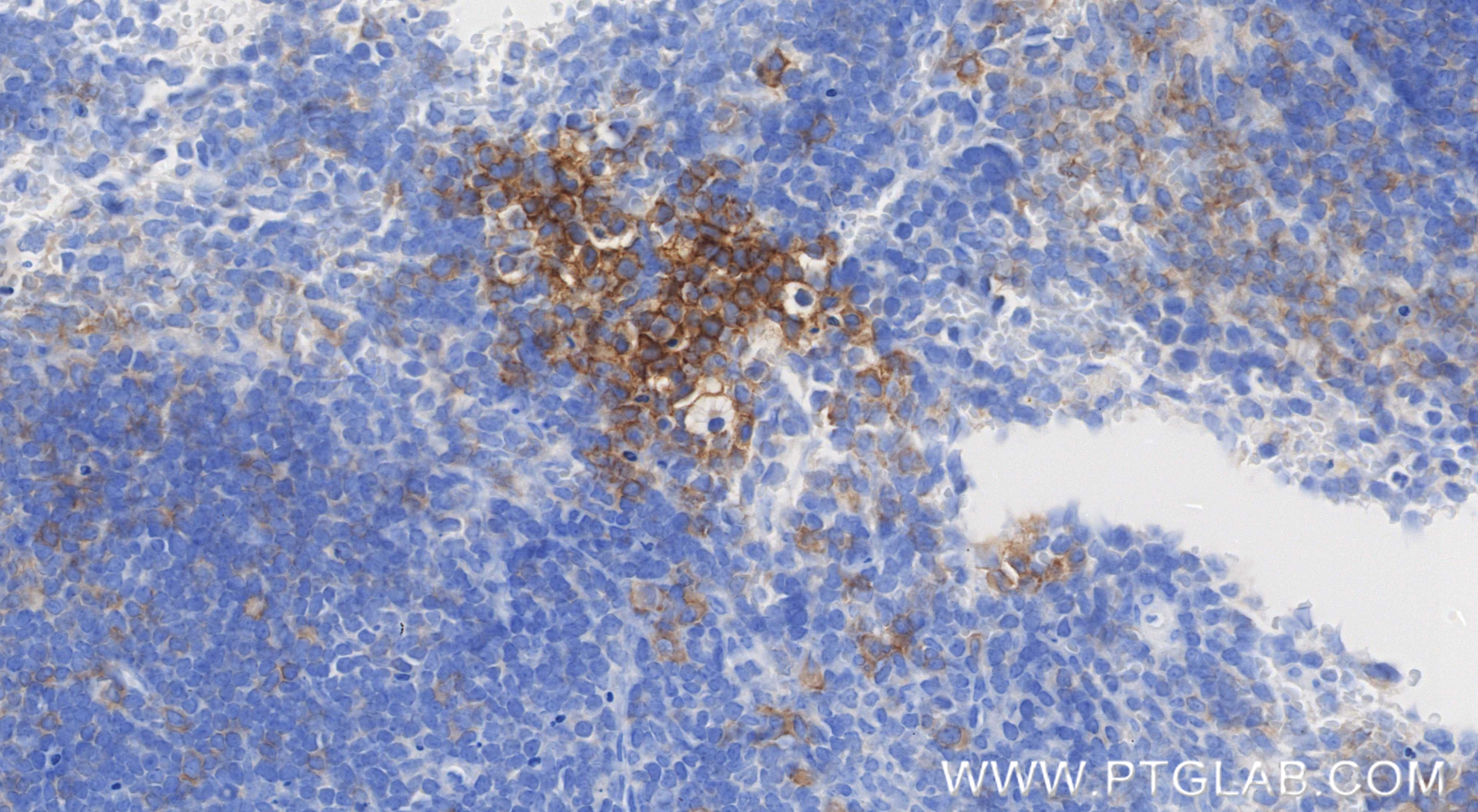 Immunohistochemistry (IHC) staining of mouse spleen tissue using TNFRSF13B/CD267 Recombinant monoclonal antibody (85902-1-RR)