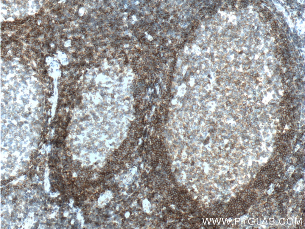 Immunohistochemistry (IHC) staining of human tonsillitis tissue using TNFRSF13C Polyclonal antibody (22582-1-AP)