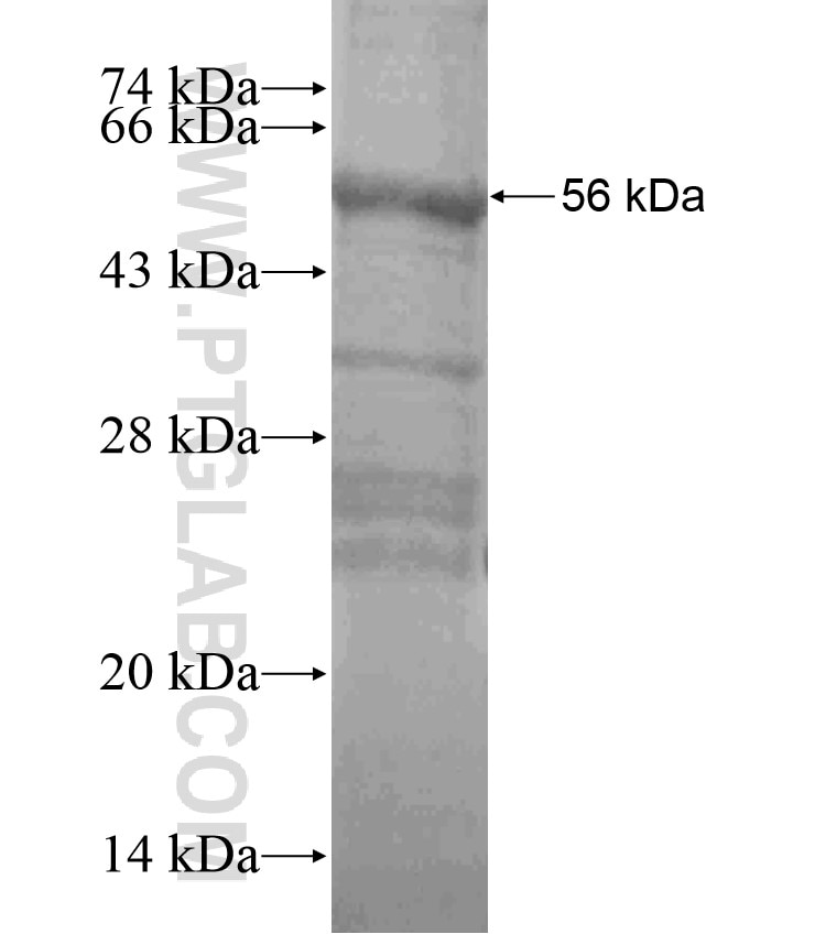 TNFRSF13C fusion protein Ag18202 SDS-PAGE
