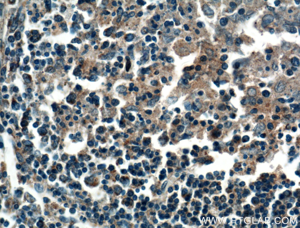 Immunohistochemistry (IHC) staining of human spleen tissue using HVEM/TNFRSF14 Polyclonal antibody (10138-1-AP)