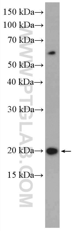 Western Blot (WB) analysis of Raji cells using BCMA/TNFRSF17 Polyclonal antibody (27724-1-AP)