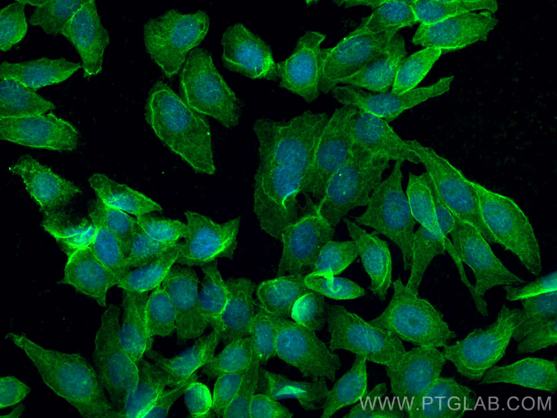 Immunofluorescence (IF) / fluorescent staining of HepG2 cells using TNFRSF21 Monoclonal antibody (66754-1-Ig)